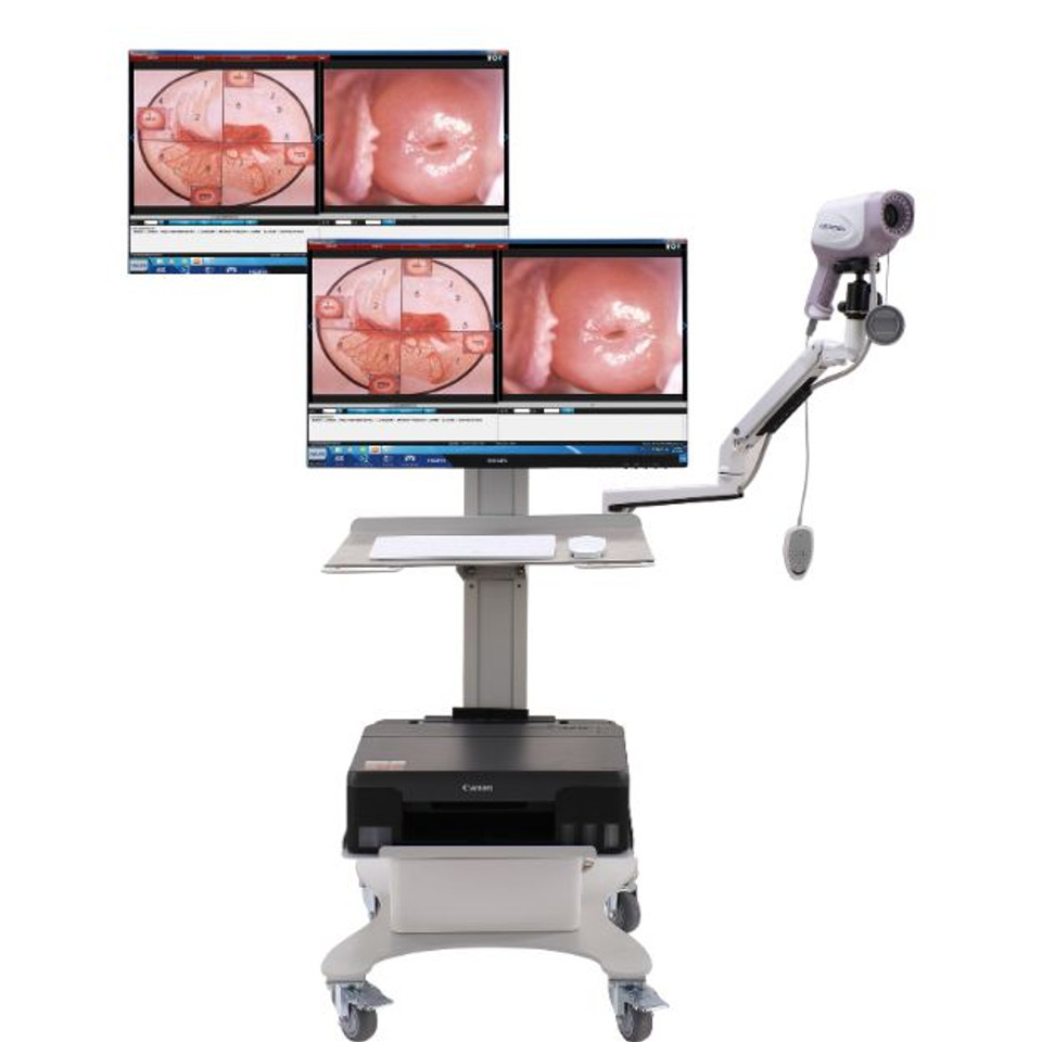 Colposcopio Digitale HD 4K CE  - Women'S Health & Wellness Center recensione e prezzo